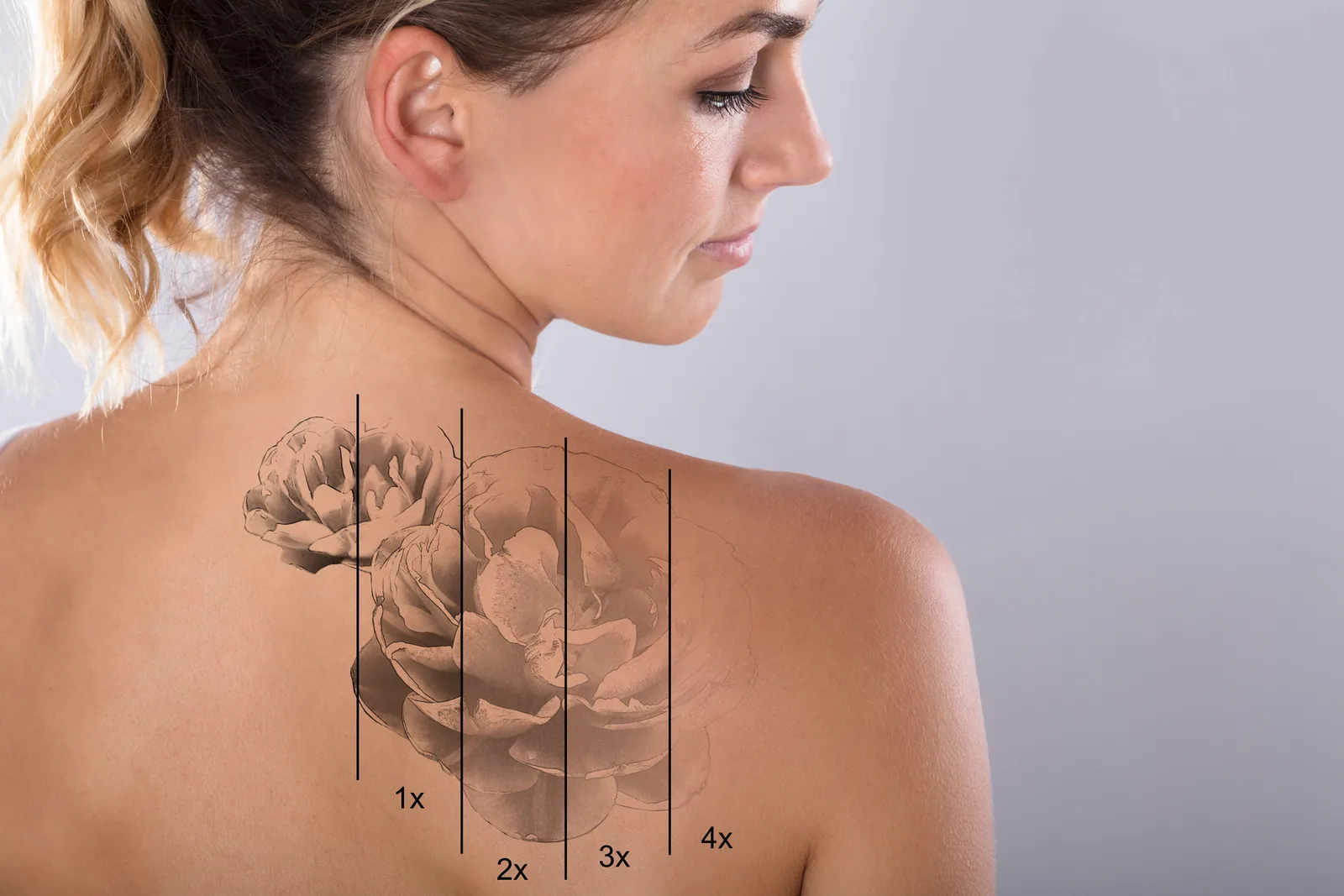 Rug van een vrouw met een tattoo die stap voor stap vervaagt na laserbehandelingen.