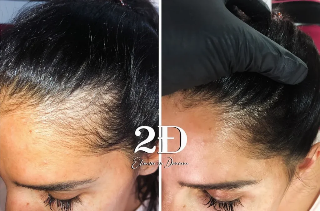 2ED Esthetique Uccle – Massage Bruxelles – Epilation laser – Soin visage