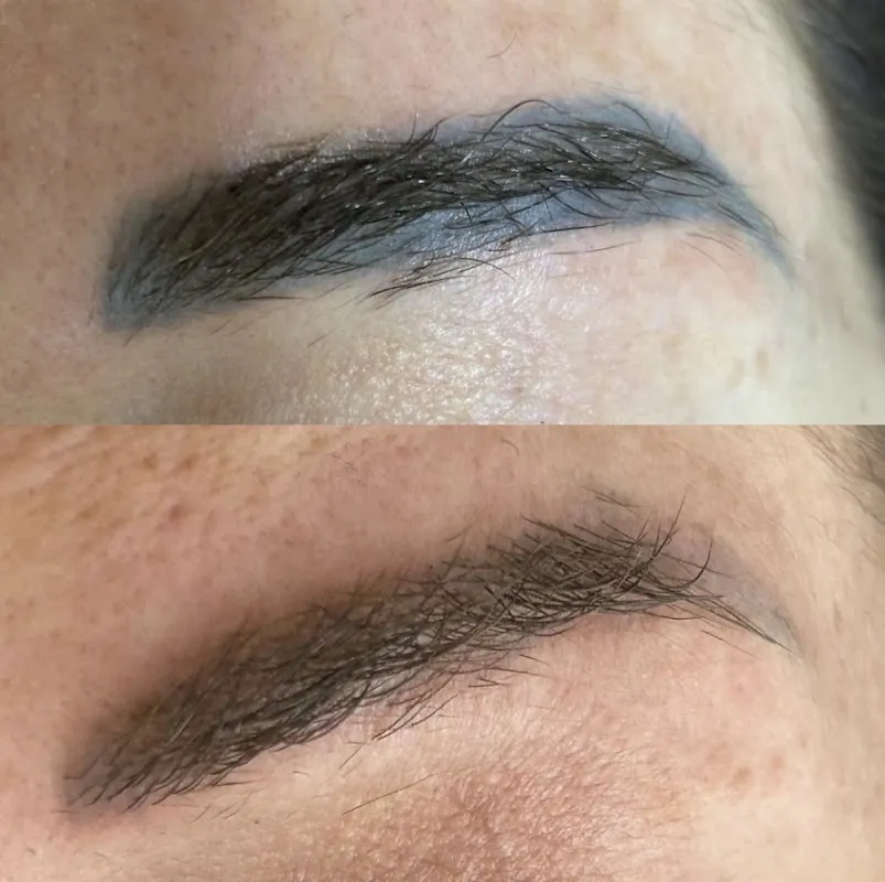DERMA ART