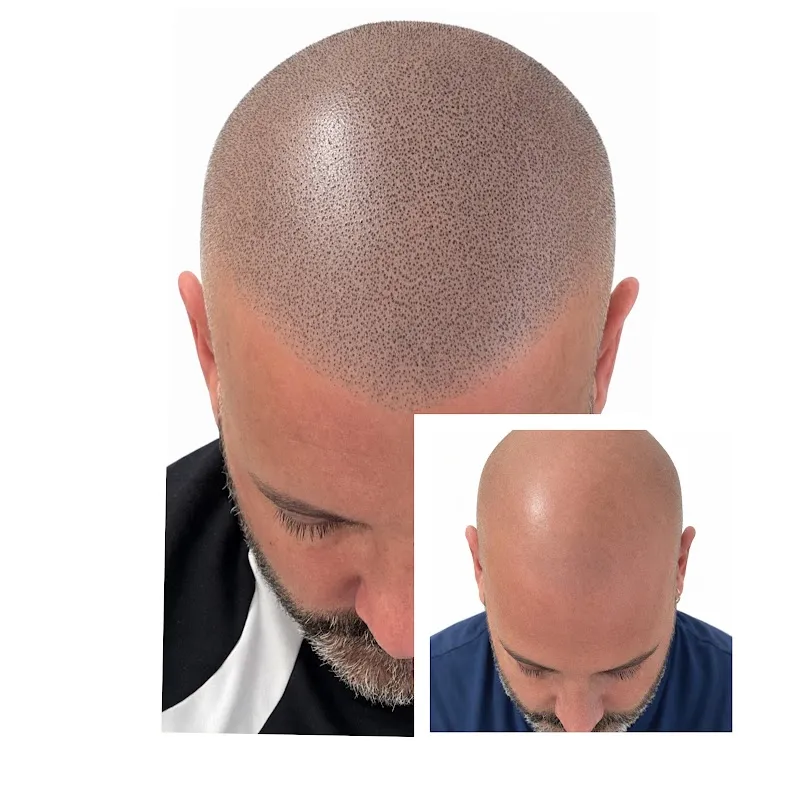 Hairsolution Expert – Micropigmentation