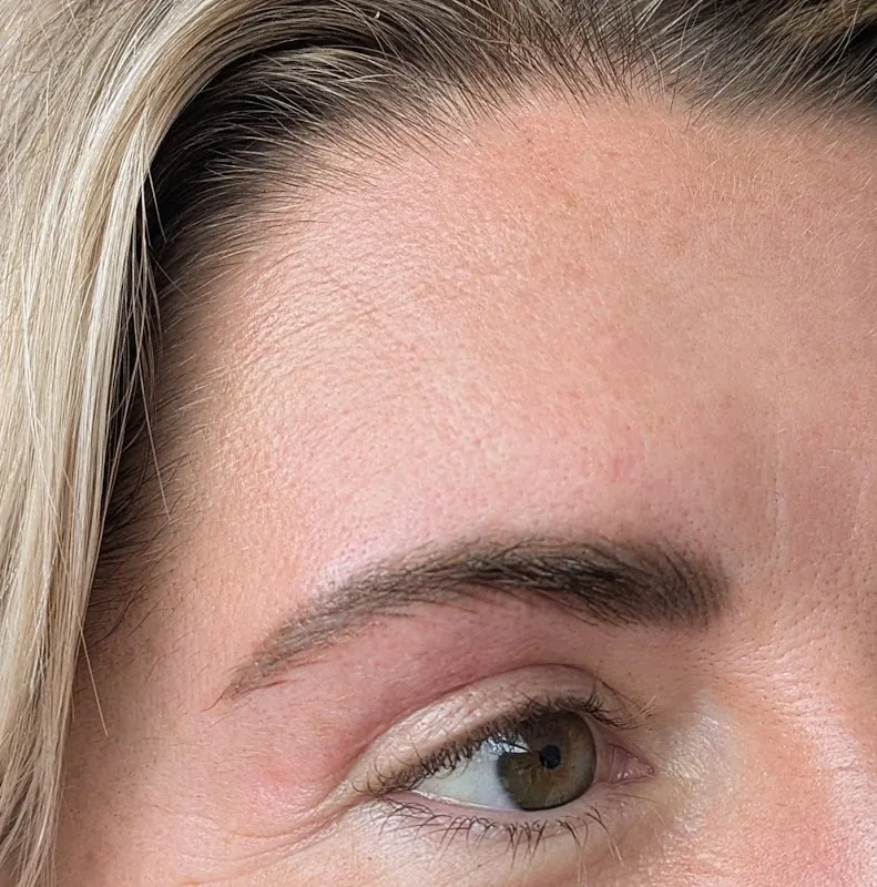 Kobie Fossey