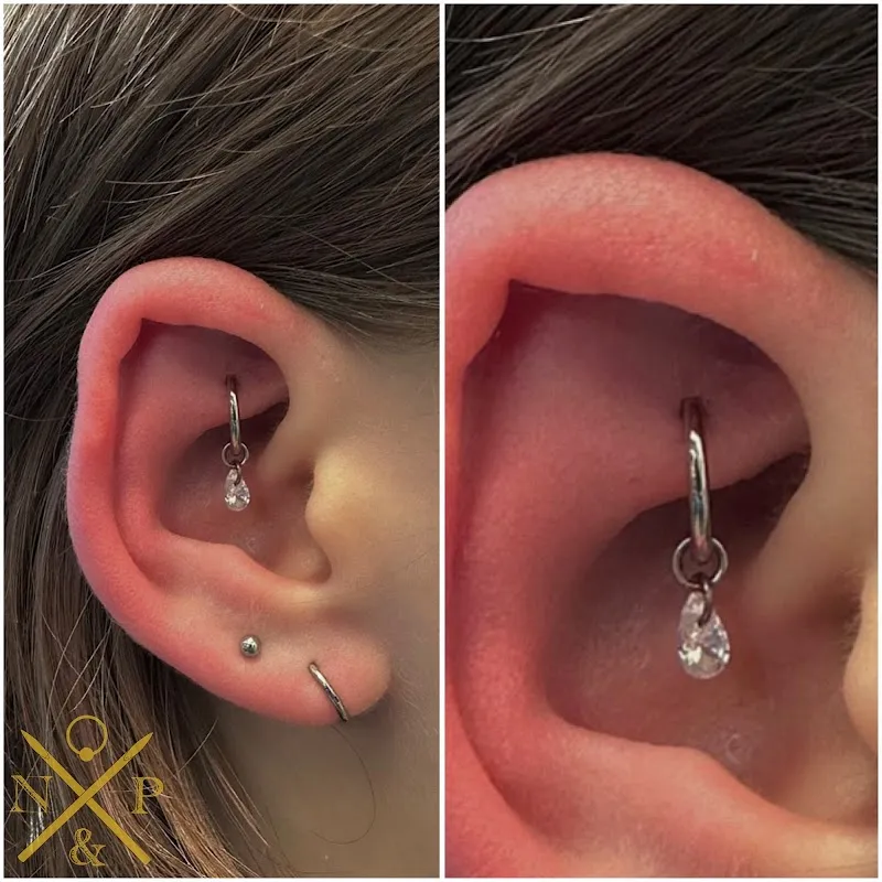 Needles and Pins